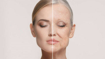 Comparison. Portrait of beautiful woman with problem and clean skin, aging and youth concept, beauty treatment